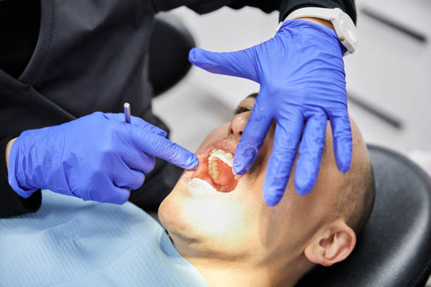 Best Emergency Broken Tooth Repair in Hopatcong, NJ